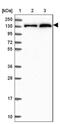 Nuclear Receptor Corepressor 1 antibody, NBP2-47360, Novus Biologicals, Western Blot image 