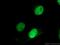 Double-strand-break repair protein rad21 homolog antibody, 27071-1-AP, Proteintech Group, Immunofluorescence image 