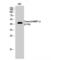 Matrix Metallopeptidase 12 antibody, LS-C380505, Lifespan Biosciences, Western Blot image 