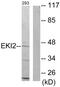 Ethanolamine kinase 2 antibody, PA5-38807, Invitrogen Antibodies, Western Blot image 
