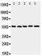 Myocyte Enhancer Factor 2A antibody, PA1823, Boster Biological Technology, Western Blot image 