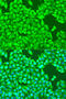 Tubulin Beta 8 Class VIII antibody, 14-544, ProSci, Immunofluorescence image 