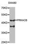 cAMP-dependent protein kinase catalytic subunit beta antibody, STJ27277, St John