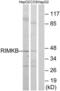 Ribosomal Modification Protein RimK Like Family Member B antibody, LS-C120340, Lifespan Biosciences, Western Blot image 