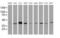 Alpha-1,4-N-Acetylglucosaminyltransferase antibody, MA5-26434, Invitrogen Antibodies, Western Blot image 