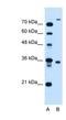 TMEM231 antibody, NBP1-59823, Novus Biologicals, Western Blot image 