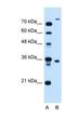 Transmembrane Protein 231 antibody, NBP1-59823, Novus Biologicals, Western Blot image 