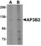 Adaptor Related Protein Complex 3 Subunit Beta 2 antibody, LS-B8797, Lifespan Biosciences, Western Blot image 