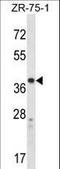 Cysteinyl Leukotriene Receptor 1 antibody, LS-C167249, Lifespan Biosciences, Western Blot image 