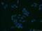 Endosulfine Alpha antibody, 14518-1-AP, Proteintech Group, Immunofluorescence image 