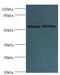 Alkaline Phosphatase, Placental antibody, LS-C375221, Lifespan Biosciences, Western Blot image 