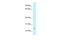 Coiled-Coil Domain Containing 85B antibody, A11669, Boster Biological Technology, Western Blot image 