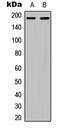 Insulin Receptor Substrate 1 antibody, LS-C358786, Lifespan Biosciences, Western Blot image 