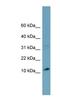 Tripartite Motif Containing 36 antibody, NBP1-54924, Novus Biologicals, Western Blot image 