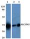 Solute Carrier Family 25 Member 5 antibody, GTX66797, GeneTex, Western Blot image 