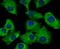 Sorting Nexin 1 antibody, A02692-1, Boster Biological Technology, Immunocytochemistry image 