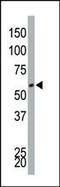 Dual Specificity Tyrosine Phosphorylation Regulated Kinase 4 antibody, 62-969, ProSci, Western Blot image 