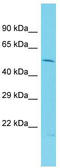 VPS33B Interacting Protein, Apical-Basolateral Polarity Regulator, Spe-39 Homolog antibody, TA344707, Origene, Western Blot image 