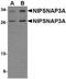 Nipsnap Homolog 3A antibody, NBP1-76968, Novus Biologicals, Western Blot image 