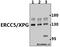 ERCC Excision Repair 5, Endonuclease antibody, A01770-1, Boster Biological Technology, Western Blot image 