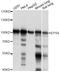 Epidermal Growth Factor Receptor Pathway Substrate 8 antibody, A14730, ABclonal Technology, Western Blot image 
