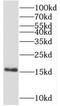 Late Endosomal/Lysosomal Adaptor, MAPK And MTOR Activator 1 antibody, FNab10210, FineTest, Western Blot image 