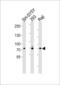 Fibroblast Growth Factor Receptor 4 antibody, LS-C97524, Lifespan Biosciences, Western Blot image 