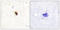 Aurora Kinase B antibody, LS-C198662, Lifespan Biosciences, Immunohistochemistry paraffin image 