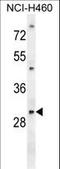 Phosphoglycerate Mutase 2 antibody, LS-C163544, Lifespan Biosciences, Western Blot image 