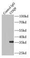 Coenzyme Q9 antibody, FNab01881, FineTest, Immunoprecipitation image 