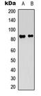 Ataxin 1 antibody, LS-C358916, Lifespan Biosciences, Western Blot image 