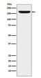 RE1 Silencing Transcription Factor antibody, M03852, Boster Biological Technology, Western Blot image 