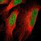 Vezatin, Adherens Junctions Transmembrane Protein antibody, PA5-52115, Invitrogen Antibodies, Immunofluorescence image 