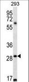 Mesoderm Posterior BHLH Transcription Factor 1 antibody, LS-C164145, Lifespan Biosciences, Western Blot image 