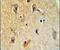 Beta-1,4-Galactosyltransferase 6 antibody, PA5-24190, Invitrogen Antibodies, Immunohistochemistry paraffin image 