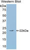 Angiopoietin 1 antibody, LS-C292804, Lifespan Biosciences, Western Blot image 