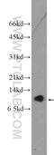 C-X9-C Motif Containing 2 antibody, 26086-1-AP, Proteintech Group, Western Blot image 