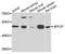 Myosin Regulatory Light Chain Interacting Protein antibody, A6166, ABclonal Technology, Western Blot image 