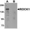 Rho Associated Coiled-Coil Containing Protein Kinase 1 antibody, A00722, Boster Biological Technology, Western Blot image 