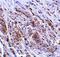 Tripartite Motif Containing 5 antibody, A01359, Boster Biological Technology, Immunohistochemistry paraffin image 