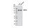 Inositol Polyphosphate-4-Phosphatase Type II B antibody, 8450S, Cell Signaling Technology, Western Blot image 