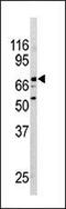 Nuclear Receptor Subfamily 4 Group A Member 2 antibody, MBS9206224, MyBioSource, Western Blot image 