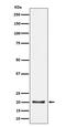 COP9 Signalosome Subunit 8 antibody, M07142, Boster Biological Technology, Western Blot image 