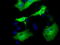 Adenylate Kinase 5 antibody, LS-C115583, Lifespan Biosciences, Immunofluorescence image 