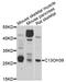 Methyltransferase Like 21C antibody, STJ112439, St John