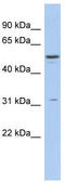 Tripartite motif-containing protein 14 antibody, TA338077, Origene, Western Blot image 