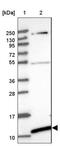 BolA Family Member 2B antibody, NBP2-46726, Novus Biologicals, Western Blot image 