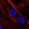 Suprabasin antibody, HPA067734, Atlas Antibodies, Immunofluorescence image 