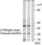 Complement C1r antibody, abx015582, Abbexa, Western Blot image 