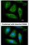 Receptor Interacting Serine/Threonine Kinase 1 antibody, PA5-29223, Invitrogen Antibodies, Immunofluorescence image 